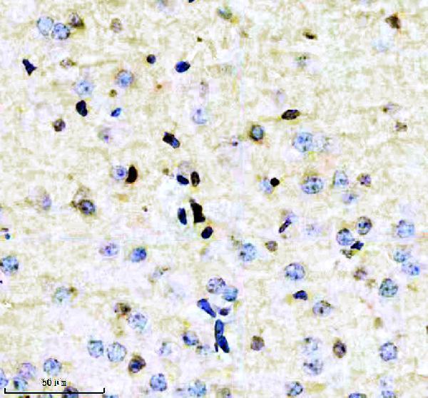 IHC analysis of CRKL using anti-CRKL antibody (M02100-2)