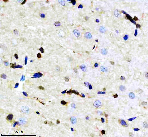 m02100 2 crkl primary antibodies ihc testing 4