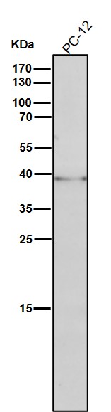 All lanes use the Antibody at 1:1K dilution for 1 hour at room temperature