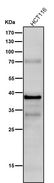 All lanes use the Antibody at 1:1K dilution for 1 hour at room temperature