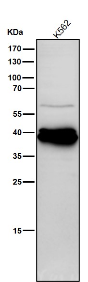 All lanes use the Antibody at 1:1K dilution for 1 hour at room temperature
