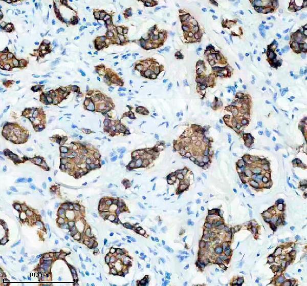 m02101 1 krt19 primary antibodies ihc testing 1