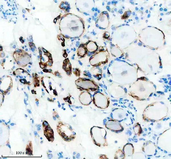 m02101 1 krt19 primary antibodies ihc testing 2