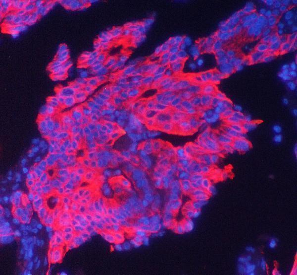 m02101 2 cytokeratin_19 primary antibodies if testing 3