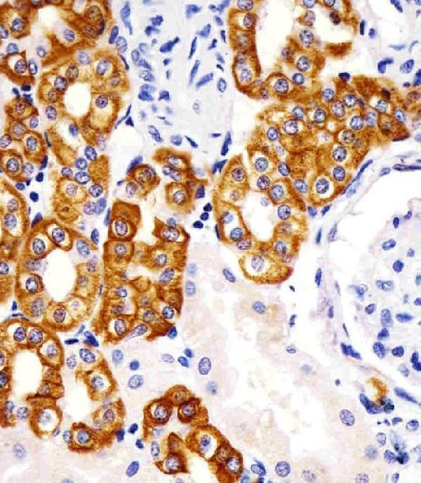 m02101 5 anti krt19 antibody ihc p testing 4