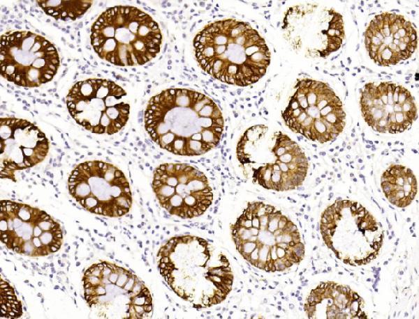 m02101 5 anti krt19 antibody ihc testing 3