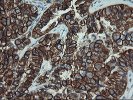 m02101 6 anti cytokeratin 19 krt19 mouse monoclonal antibody clone id oti3f8 ihc testing 3