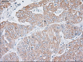 m02101 6 anti cytokeratin 19 krt19 mouse monoclonal antibody clone id oti3f8 ihc testing 4