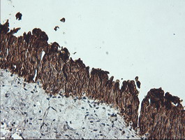 m02101 6 anti cytokeratin 19 krt19 mouse monoclonal antibody clone id oti3f8 ihc testing 5