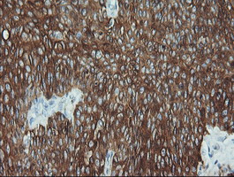 m02101 6 anti cytokeratin 19 krt19 mouse monoclonal antibody clone id oti3f8 ihc testing 6