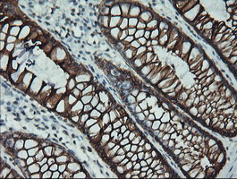 m02101 6 anti cytokeratin 19 krt19 mouse monoclonal antibody clone id oti3f8 ihc testing 7