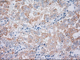 m02101 6 anti cytokeratin 19 krt19 mouse monoclonal antibody clone id oti3f8 ihc testing 9