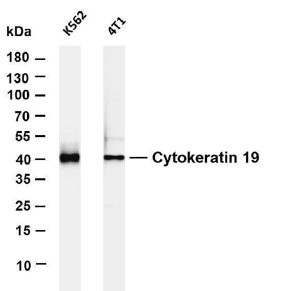 m02101 8 krt19 primary antibodies wb testing 1