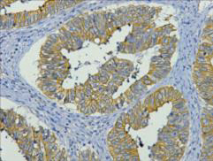 m02101 krt19 primary antibodies ihc testing 2