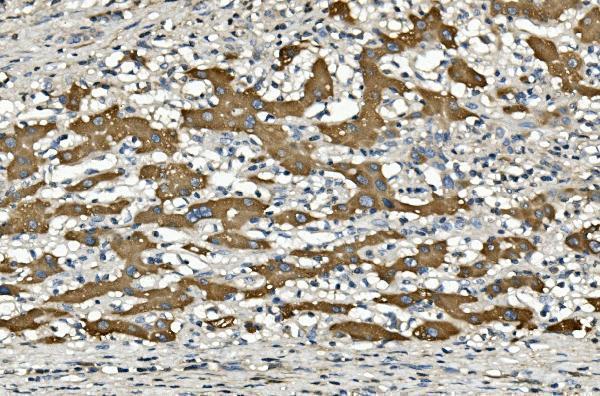  IHC analysis of Cytochrome p450 2C19/CYP2C19 using anti-Cytochrome p450 2C19/CYP2C19 antibody (M02102-1)