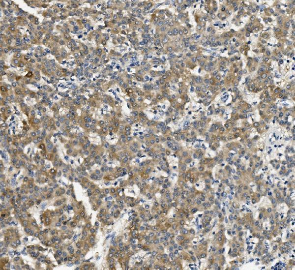  IHC analysis of Cytochrome p450 2C19/CYP2C19 using anti-Cytochrome p450 2C19/CYP2C19 antibody (M02102)