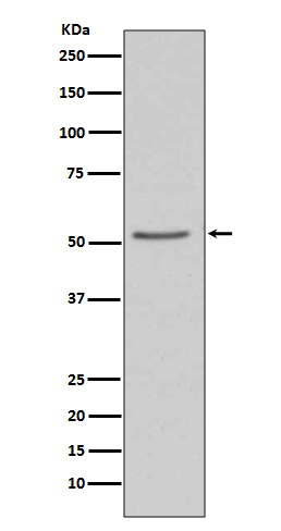 Western blot analysis of Angiotensinogen expression in 293T cell lysate