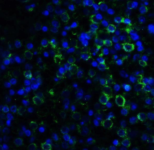 m02107 1 ly96 primary antibodies if testing 4