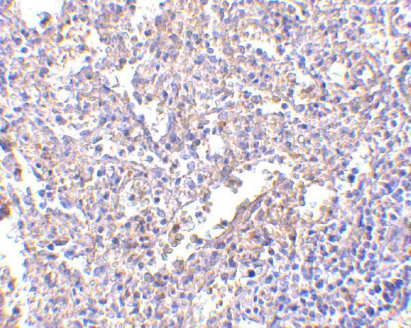 Immunohistochemistry of MD-2 in human spleen with MD-2 antibody at 2