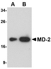 Western blot analysis of (A) 25 and (B) 125 ng of MD-2 recombinant protein with MD-2 antibody at 1 μg/mL
