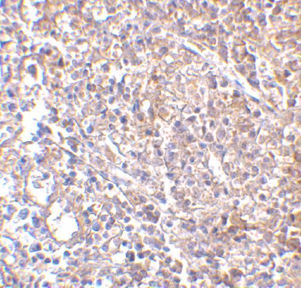 m02107 ly96 primary antibodies ihc testing 2
