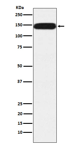 Western blot analysis of Pumilio 1 expression in HeLa cell lysate
