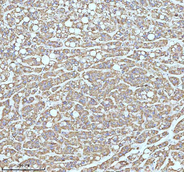 m02112 cpt2 primary antibodies ihc testing 10