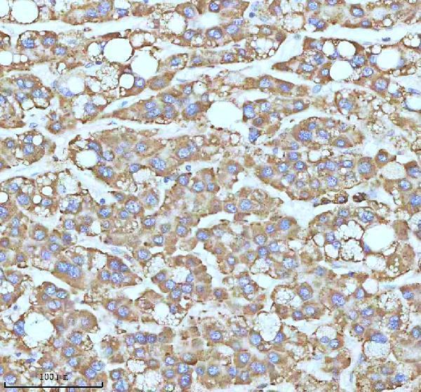 m02112 cpt2 primary antibodies ihc testing 11