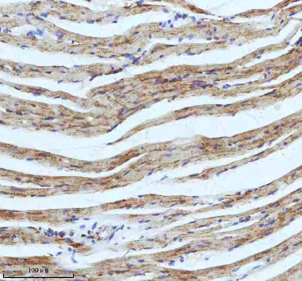 m02112 cpt2 primary antibodies ihc testing 13