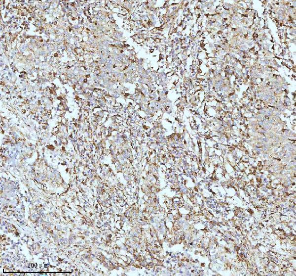 m02112 cpt2 primary antibodies ihc testing 2
