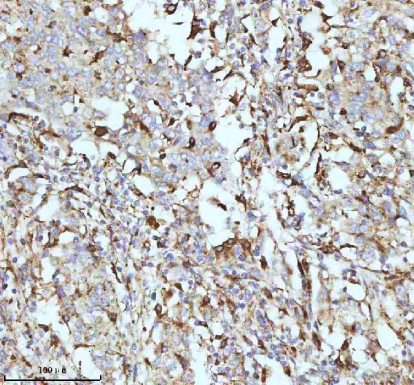 m02112 cpt2 primary antibodies ihc testing 3