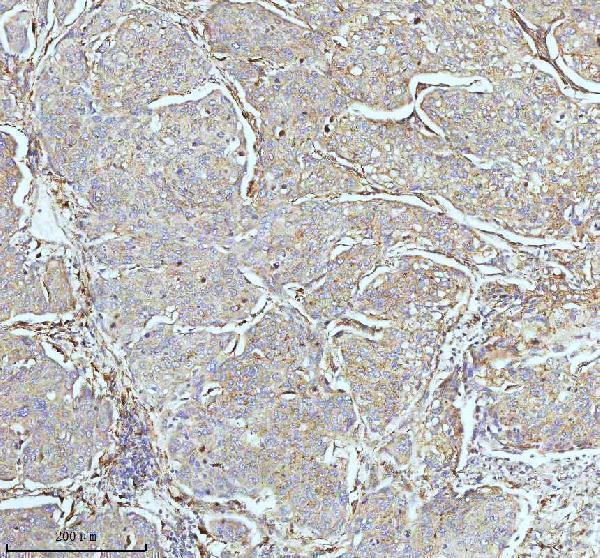 m02112 cpt2 primary antibodies ihc testing 4