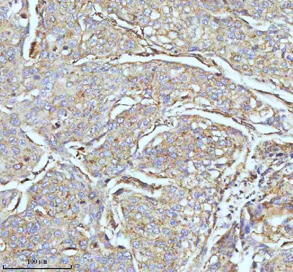 m02112 cpt2 primary antibodies ihc testing 5