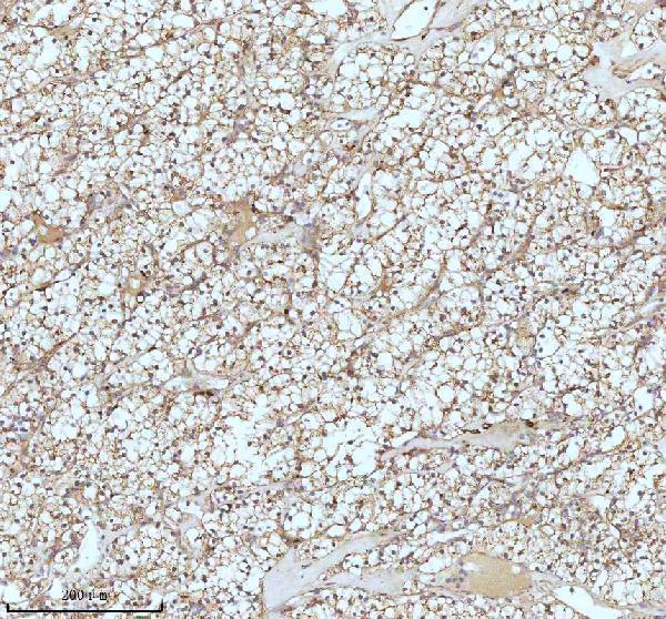 m02112 cpt2 primary antibodies ihc testing 6