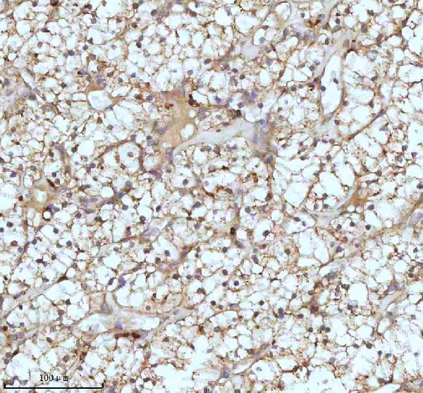 m02112 cpt2 primary antibodies ihc testing 7
