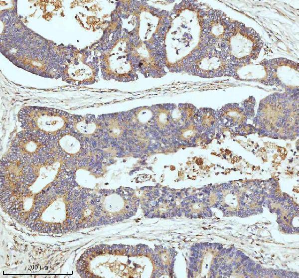 m02112 cpt2 primary antibodies ihc testing 8