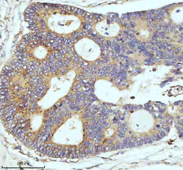 m02112 cpt2 primary antibodies ihc testing 9
