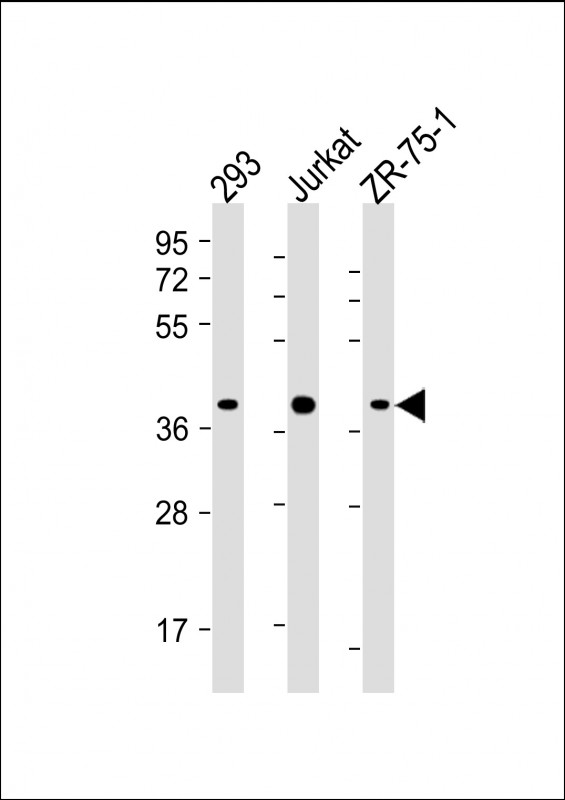 All lanes : Anti-HIF1AN Antibody (C-term) at 1:4000 dilutionLane 1: 293 whole cell lysateLane 2: Jurkat whole cell lysateLane 3: ZR-75-1 whole cell lysateLysates/proteins at 20 µg per lane