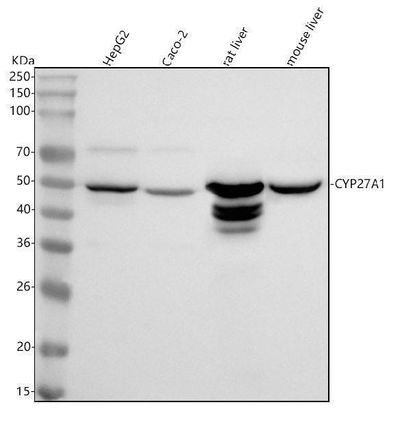  Western blot analysis of CYP27A1 using anti-CYP27A1 antibody (M02121-1)