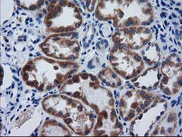 Immunohistochemical staining of paraffin-embedded Human Kidney tissue within the normal limits using anti-GCKR mouse monoclonal antibody