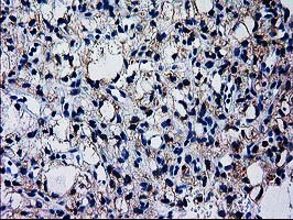 m02122 anti gckr mouse monoclonal antibody clone id oti1e7 ihc testing 4