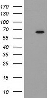 HEK293T cells were transfected with the pCMV6-ENTRY control (Left lane) or pCMV6-ENTRY GCKR (Right lane) cDNA for 48 hrs and lysed