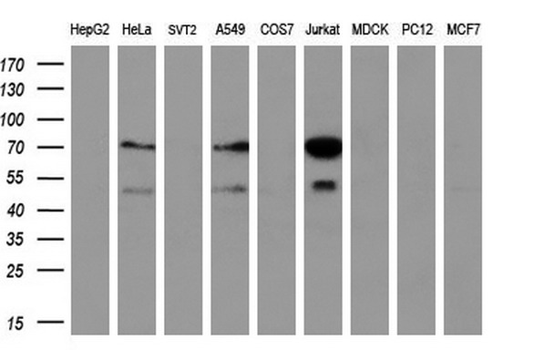 Western blot analysis of extracts (35ug) from 9 different cell lines by using anti-GCKR monoclonal antibody (HepG2: human; HeLa: human; SVT2: mouse; A549: human; COS7: monkey; Jurkat: human; MDCK: canine; PC12: rat; MCF7: human) (1:200)