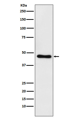 Western blot analysis of CtBP1 expression in Raji cell lysate