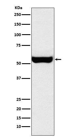 Western blot analysis of Monoamine Oxidase B expression in SH-SY5Y cell lysate