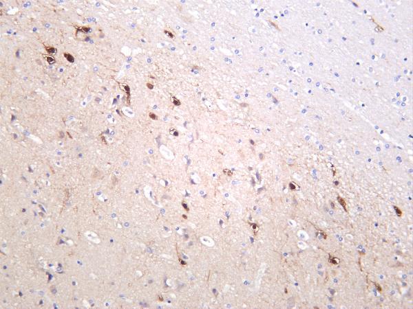 Human brain was stained with anti-PSD95 rabbit antibody