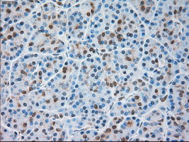 m02130 anti trpm4 mouse monoclonal antibody clone id oti10h5 ihc testing 5
