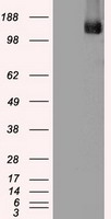 HEK293T cells were transfected with the pCMV6-ENTRY control (Left lane) or pCMV6-ENTRY TRPM4 (Right lane) cDNA for 48 hrs and lysed