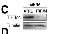Figure from citation: Western Blot of TRPM4 protein level by using anti-TRPM4 antibody in human endothelial cells