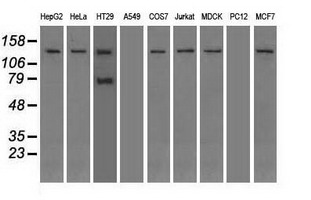 Western blot analysis of extracts (35ug) from 9 different cell lines by using anti-TRPM4 monoclonal antibody